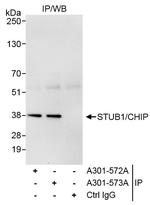 STUB1/CHIP Antibody in Immunoprecipitation (IP)