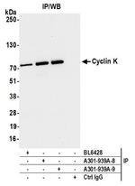 Cyclin K Antibody in Immunoprecipitation (IP)