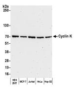 Cyclin K Antibody in Western Blot (WB)