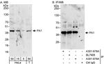 PA1 Antibody in Western Blot (WB)