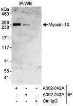 Myosin-10 Antibody in Immunoprecipitation (IP)