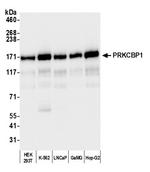 PRKCBP1 Antibody in Western Blot (WB)