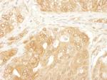 YAP1 Antibody in Immunohistochemistry (Paraffin) (IHC (P))