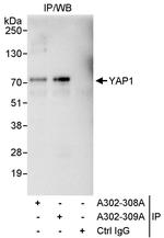 YAP1 Antibody in Immunoprecipitation (IP)