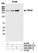 TRPM7 Antibody in Immunoprecipitation (IP)