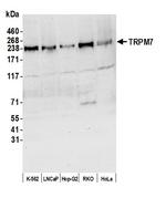 TRPM7 Antibody in Western Blot (WB)