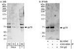 gp78 Antibody in Western Blot (WB)