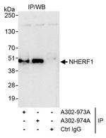 NHERF1 Antibody in Immunoprecipitation (IP)