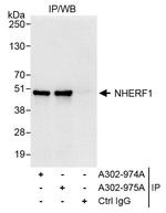 NHERF1 Antibody in Immunoprecipitation (IP)