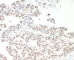 NF110 Antibody in Immunohistochemistry (Paraffin) (IHC (P))