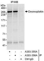 Desmoplakin Antibody in Immunoprecipitation (IP)