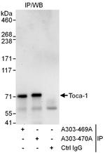 Toca-1 Antibody in Immunoprecipitation (IP)