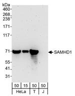 SAMHD1 Antibody in Western Blot (WB)