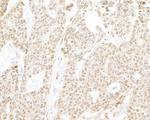 RPB3 Antibody in Immunohistochemistry (Paraffin) (IHC (P))