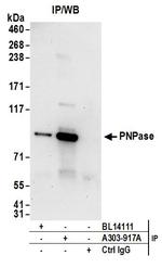 PNPase Antibody in Immunoprecipitation (IP)