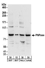 PNPase Antibody in Western Blot (WB)