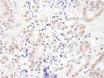 EXOSC10 Antibody in Immunohistochemistry (Paraffin) (IHC (P))