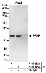 PFKP Antibody in Immunoprecipitation (IP)