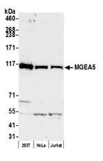 MGEA5 Antibody in Western Blot (WB)