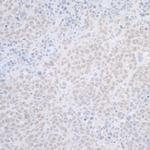 ELAC2 Antibody in Immunohistochemistry (Paraffin) (IHC (P))