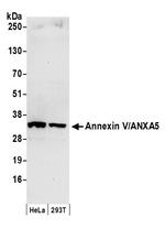 Annexin V/ANXA5 Antibody in Western Blot (WB)