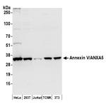 Annexin V/ANXA5 Antibody in Western Blot (WB)