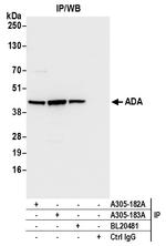 ADA/Adenosine Deaminase Antibody in Immunoprecipitation (IP)