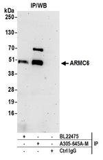 ARMC6 Antibody in Immunoprecipitation (IP)