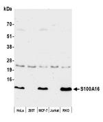 S100A16 Antibody in Western Blot (WB)