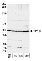 TTYH3 Antibody in Western Blot (WB)