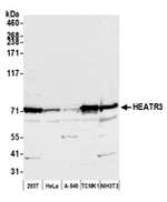 HEATR3 Antibody in Western Blot (WB)