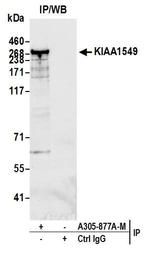 KIAA1549 Antibody in Immunoprecipitation (IP)