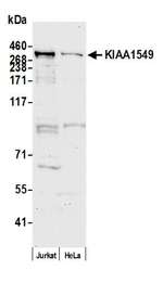 KIAA1549 Antibody in Western Blot (WB)