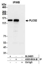 PLCG2 Antibody in Immunoprecipitation (IP)