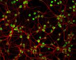 Mouse IgG (H+L) Highly Cross-Adsorbed Secondary Antibody in Immunocytochemistry (ICC/IF)