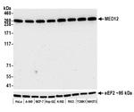 MED12 Antibody in Western Blot (WB)