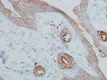 E-Cadherin Antibody in Immunohistochemistry (Paraffin) (IHC (P))