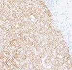 Tyrosine Hydroxylase Antibody in Immunohistochemistry (Paraffin) (IHC (P))