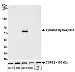 Tyrosine Hydroxylase Antibody in Western Blot (WB)