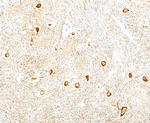 Neurofilament-L Antibody in Immunohistochemistry (Paraffin) (IHC (P))