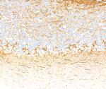 Neurofilament-L Antibody in Immunohistochemistry (Paraffin) (IHC (P))