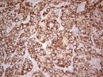 ABAT Antibody in Immunohistochemistry (Paraffin) (IHC (P))