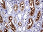 ABCB1 Antibody in Immunohistochemistry (Paraffin) (IHC (P))