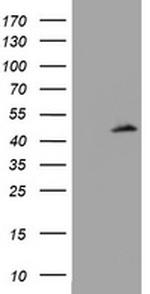 ABCB1 Antibody in Western Blot (WB)