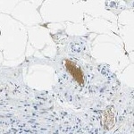 C1S Antibody in Immunohistochemistry (Paraffin) (IHC (P))