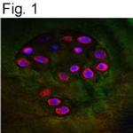 Aggrecan Neo Antibody in Immunohistochemistry (IHC)