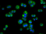 ACAT2 Antibody in Immunocytochemistry (ICC/IF)