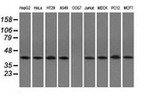 ACAT2 Antibody in Western Blot (WB)