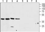 CALHM1 Antibody in Western Blot (WB)