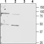 Connexin-40 (GJA5) Antibody in Western Blot (WB)